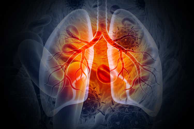 Hologic, KKR-backed Ajax Health develop lung cancer detection platform